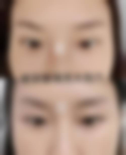 上海至臻医疗美容诊所治疗反馈与口碑评价。