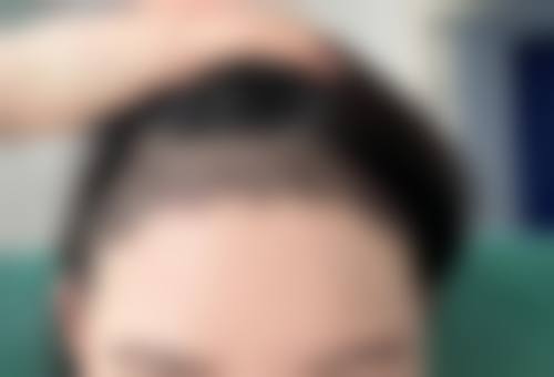 湘南美容高崎院治疗反馈与口碑评价。