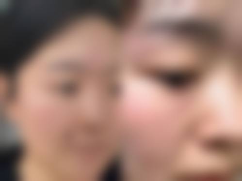 惠州元辰医疗美容门诊部治疗反馈与口碑评价。