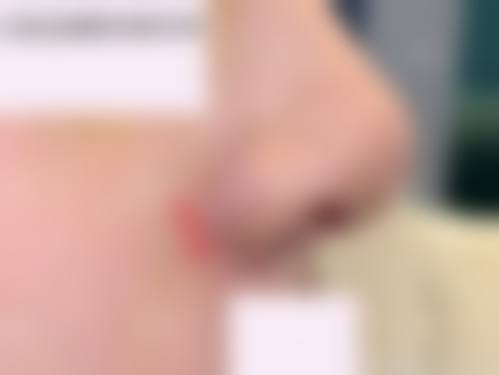 惠州元辰医疗美容门诊部项目优势明显。
