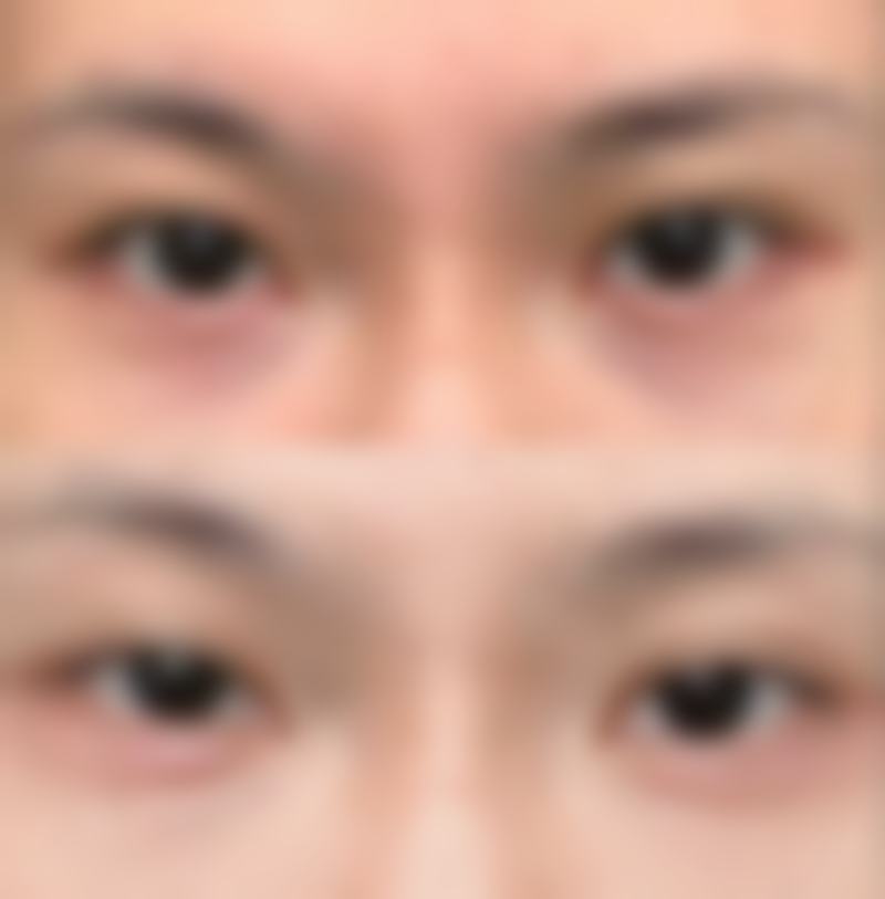 海口东湖整形美容医院2026年价格收费表: