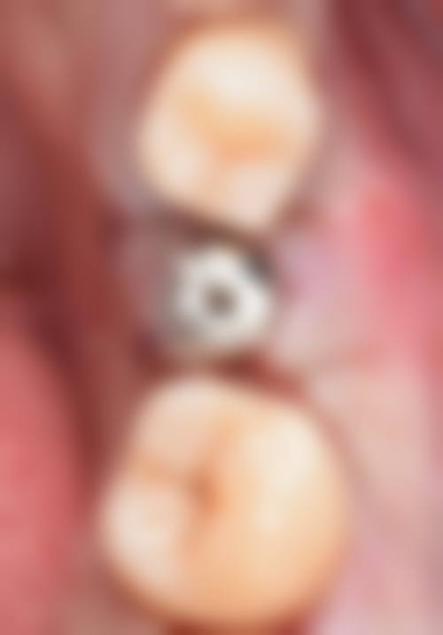 长沙开福卫牙仕口腔门诊部预约挂号方式。