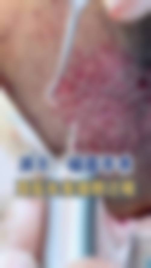深圳芝华医疗美容医院擅长项目。