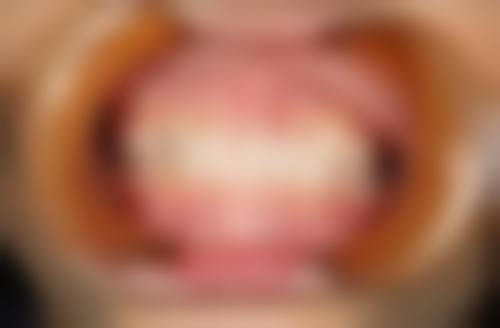 抚顺佳泽口腔诊所治疗反馈与口碑评价。