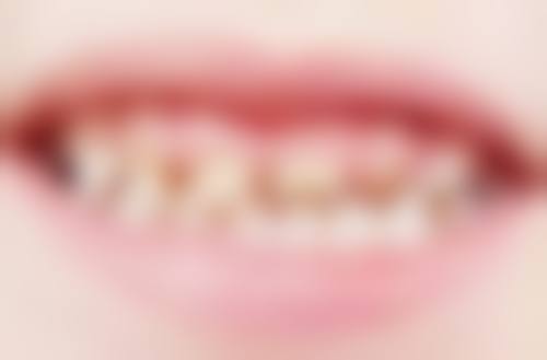 抚顺佳泽口腔诊所预约挂号方式多样。