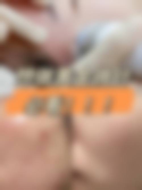 南通市妇幼保健院整形美容科治疗反馈与口碑评价。