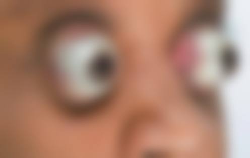 湖南长沙睛点眼科门诊有限公司擅长项目。