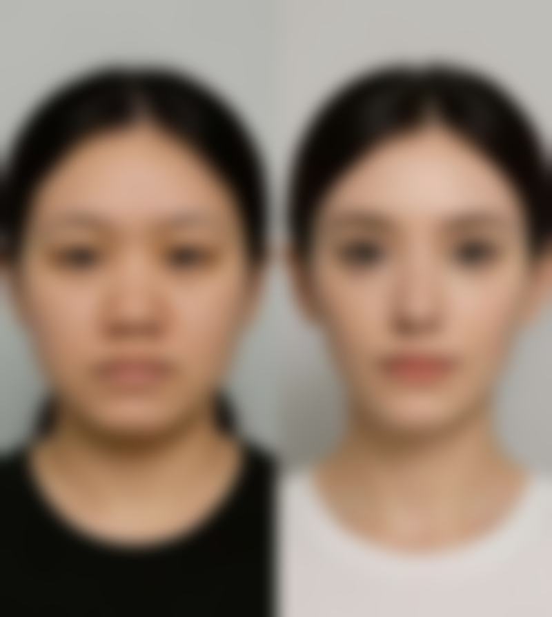 太原美雅枫医疗美容门诊部擅长项目