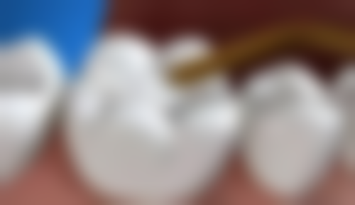 杭州哈美口腔(崇义路分店)特色诊疗项目与技术优势