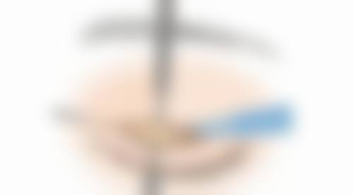 马琳医生擅长项目