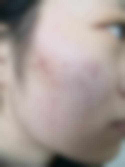 益阳金典美集医疗美容诊所治疗反馈与口碑评价。