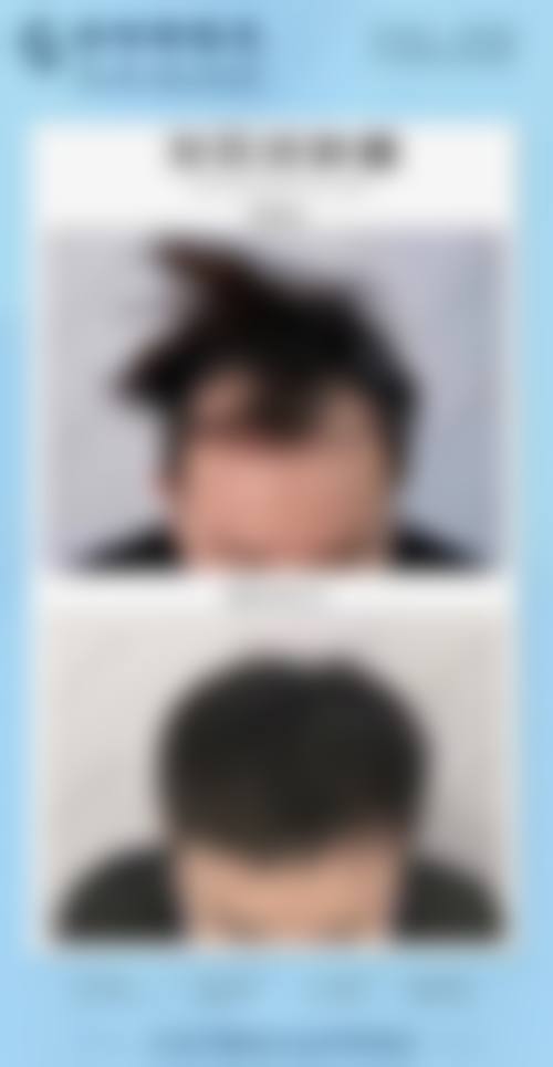 郑州都市风韵医疗美容门诊部治疗反馈与口碑评价。