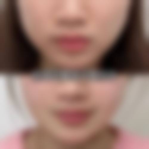 唐山颜月集医疗美容诊所治疗反馈与口碑评价。
