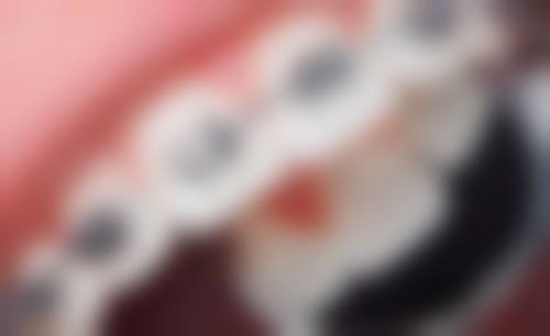 杭州品凯口腔(丰潭门诊)预约挂号方式。