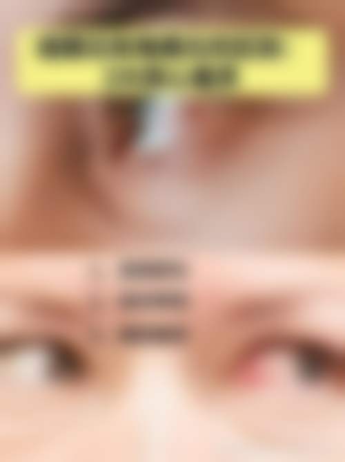昆明华山眼科医院眼科门诊营业时间。