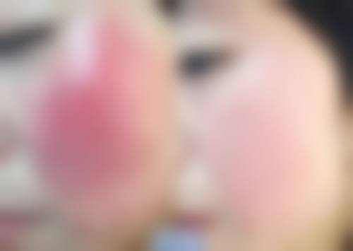 昆明婕熹卡整形医疗美容门诊部预约挂号方式。