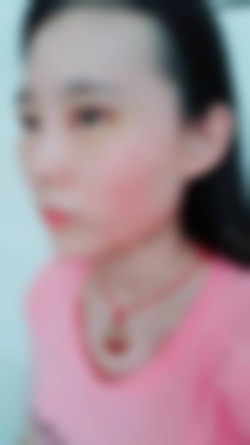 昆明婕熹卡整形医疗美容门诊部治疗反馈与口碑评价。