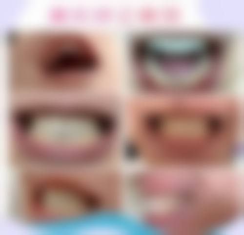 浙江宁波余姚齐文杰口腔诊所预约挂号方式。