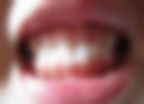 东莞虎门益民口腔擅长项目。