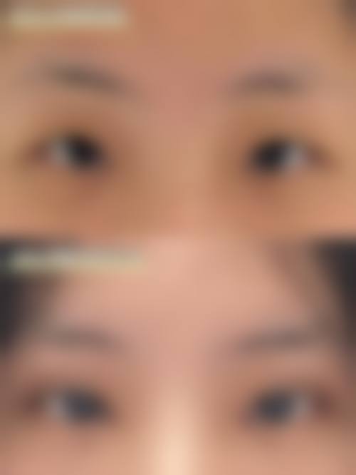 河南商丘韩艺医疗美容诊所治疗反馈与口碑评价。