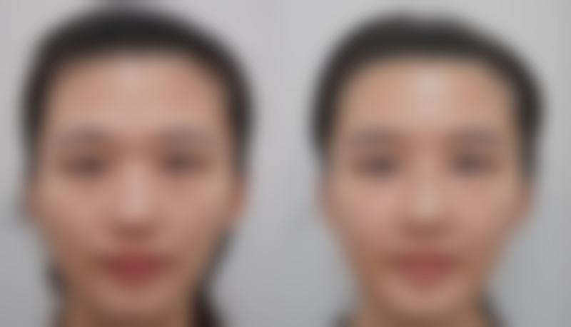 季向阳医生擅长的项目