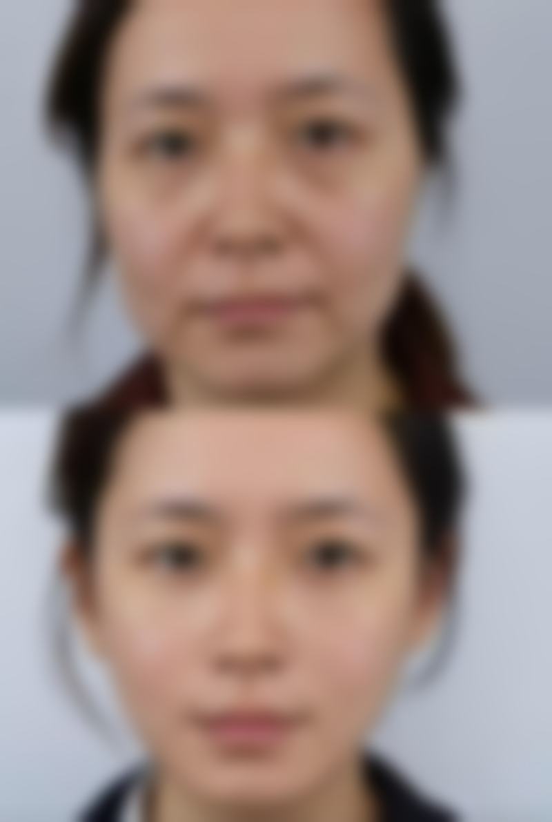 台州温岭第一人民医院烧伤整形科预约挂号方式多样。