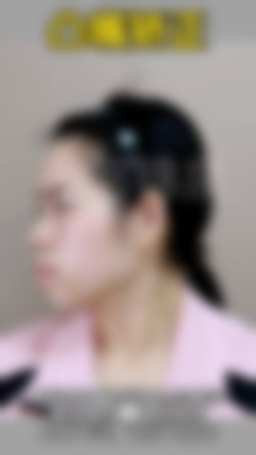 广州京穗口腔诊所擅长项目。