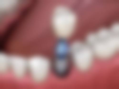 成都高新贝佳口腔门诊部特色诊疗项目与技术优势