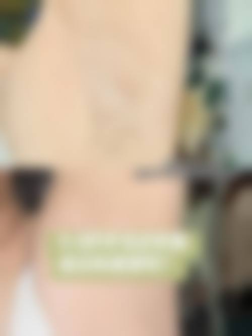 广州丘山医疗美容门诊部治疗反馈与口碑评价