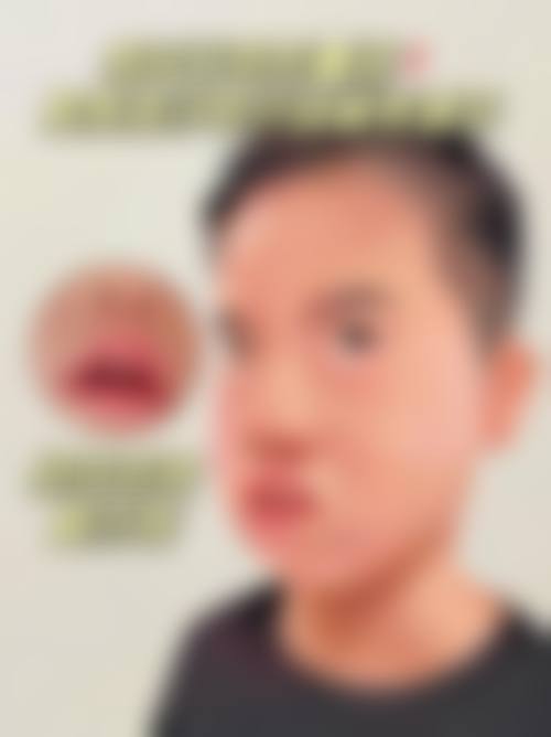 东莞钟载强口腔擅长项目