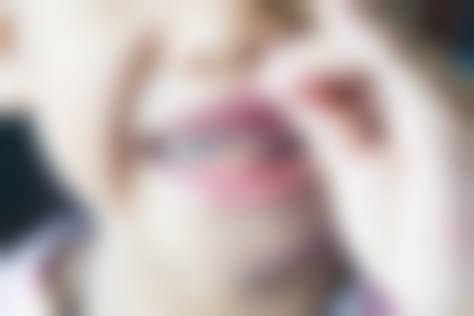 东莞钟载强口腔治疗反馈与口碑评价