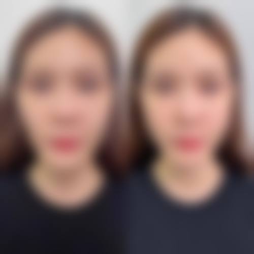 尹淑敏医生擅长项目