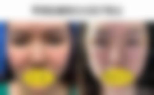 成都维莎芬美容整形医院医生团队经验稳定。