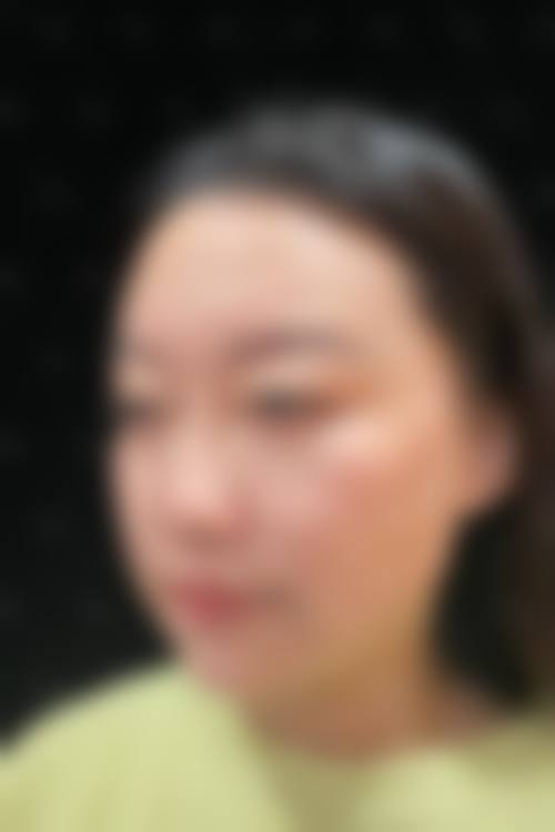 天津韩秀医疗美容门诊部治疗反馈与口碑评价。