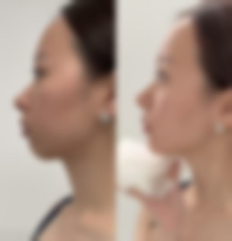 天津韩秀医疗美容门诊部口碑评价分享