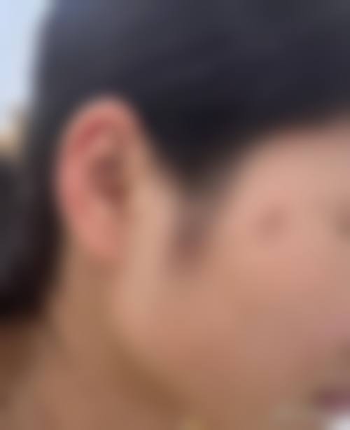 青岛亚美妍医疗美容诊所擅长项目。