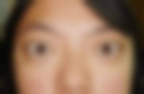 上海爱尔眼科医院整形科预约挂号方式。