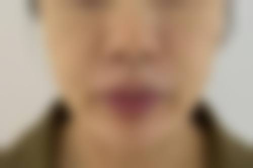 侯智群医生技术实力展示