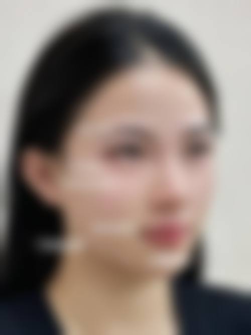 苏州爱思特整形医院的擅长项目