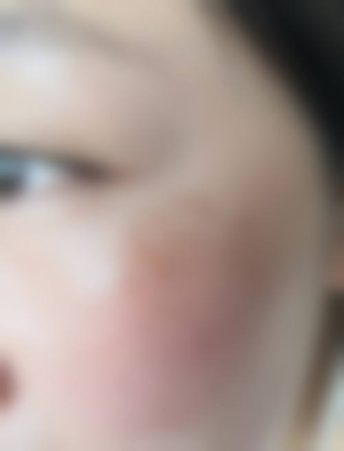 苏州爱思特整形医院预约挂号方式。