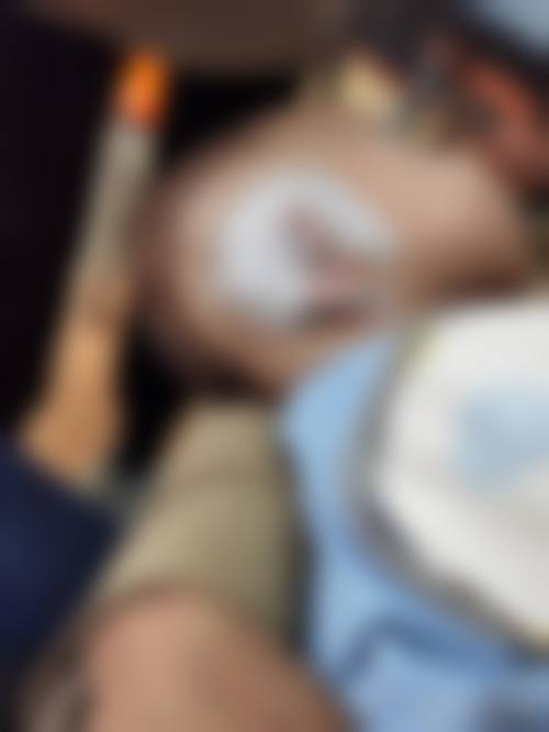 苏州爱思特整形医院治疗反馈与口碑评价。