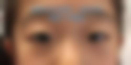廊坊市人民医院眼科治疗反馈与口碑评价。