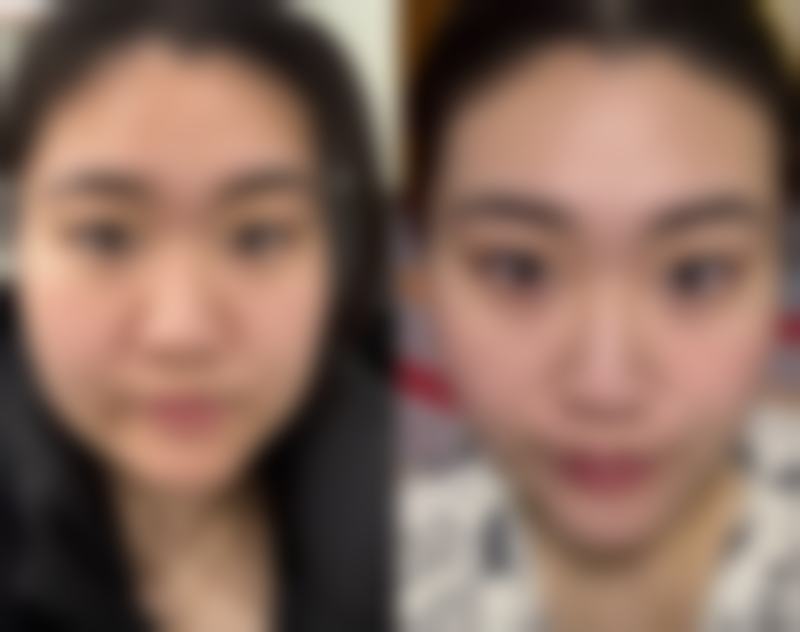 苏州爱思特整形医院口碑评价