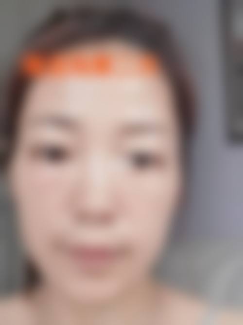 郑州星媛医疗美容治疗反馈与口碑评价。