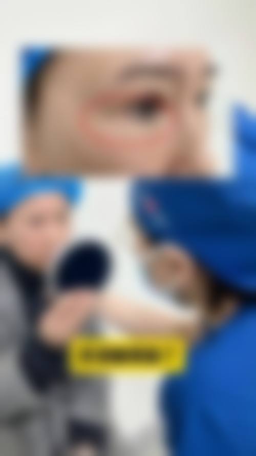 沭阳县孙宝厚整形医院治疗反馈与口碑评价。