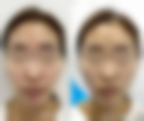 江苏江阴天美整形预约挂号方式。