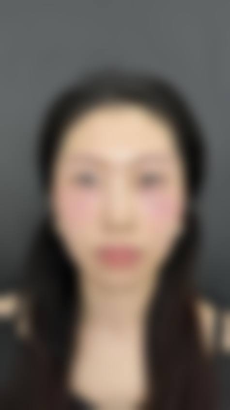 江苏江阴天美整形治疗反馈与口碑评价。