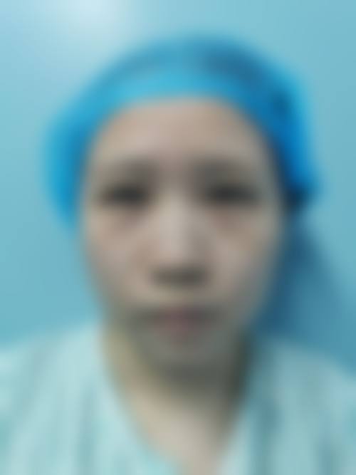 乌鲁木齐陶文君医疗美容预约挂号方式。