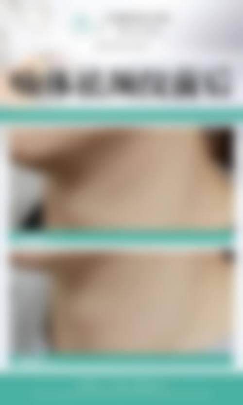 江苏江阴天美整形擅长项目。