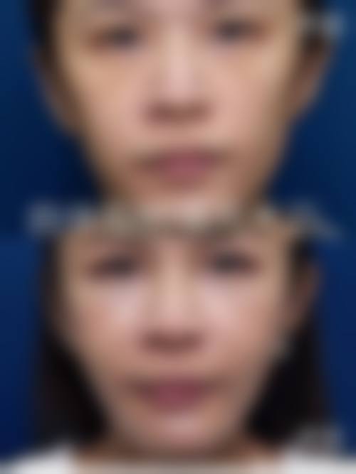 沭阳县孙宝厚整形医院预约挂号方式。